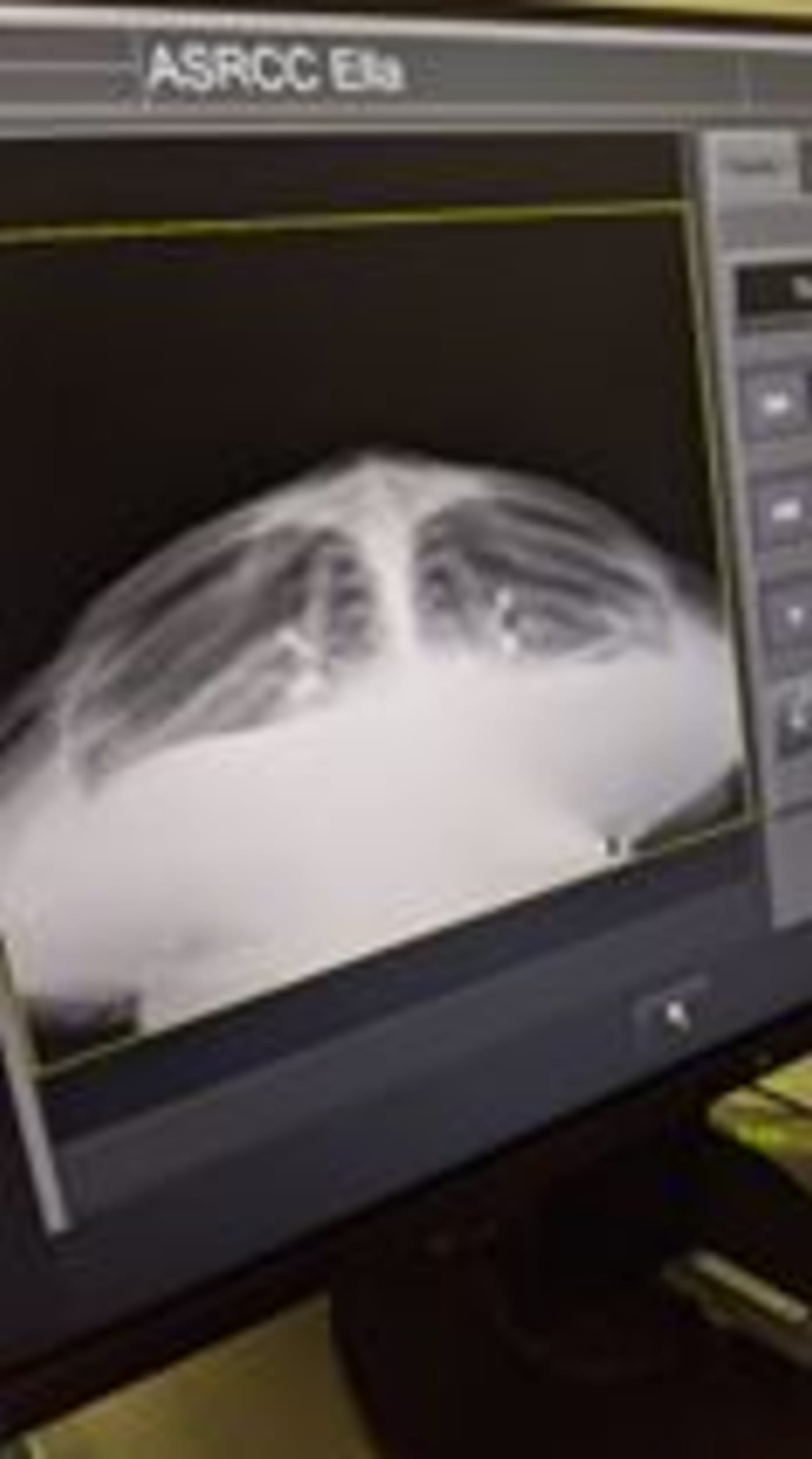X-ray of Ella the green sea turtle