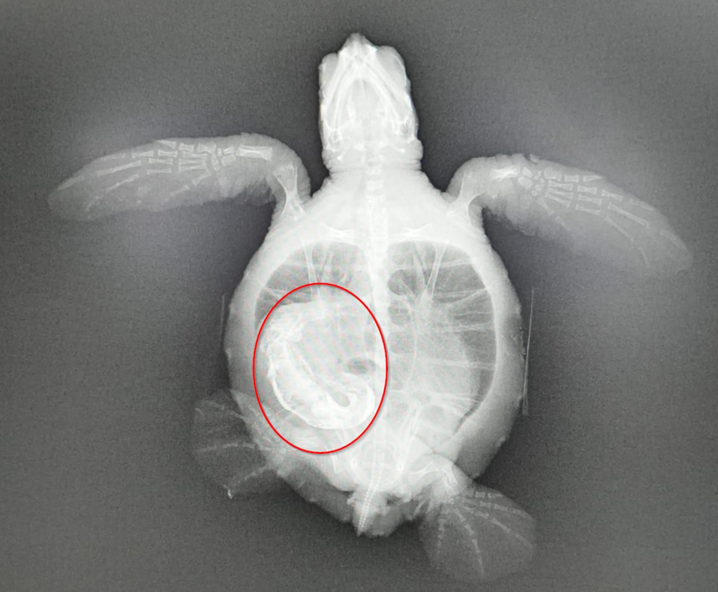 An x-ray of this green sea turtle hatchling named Pretzel showed a substantial blockage in the colon