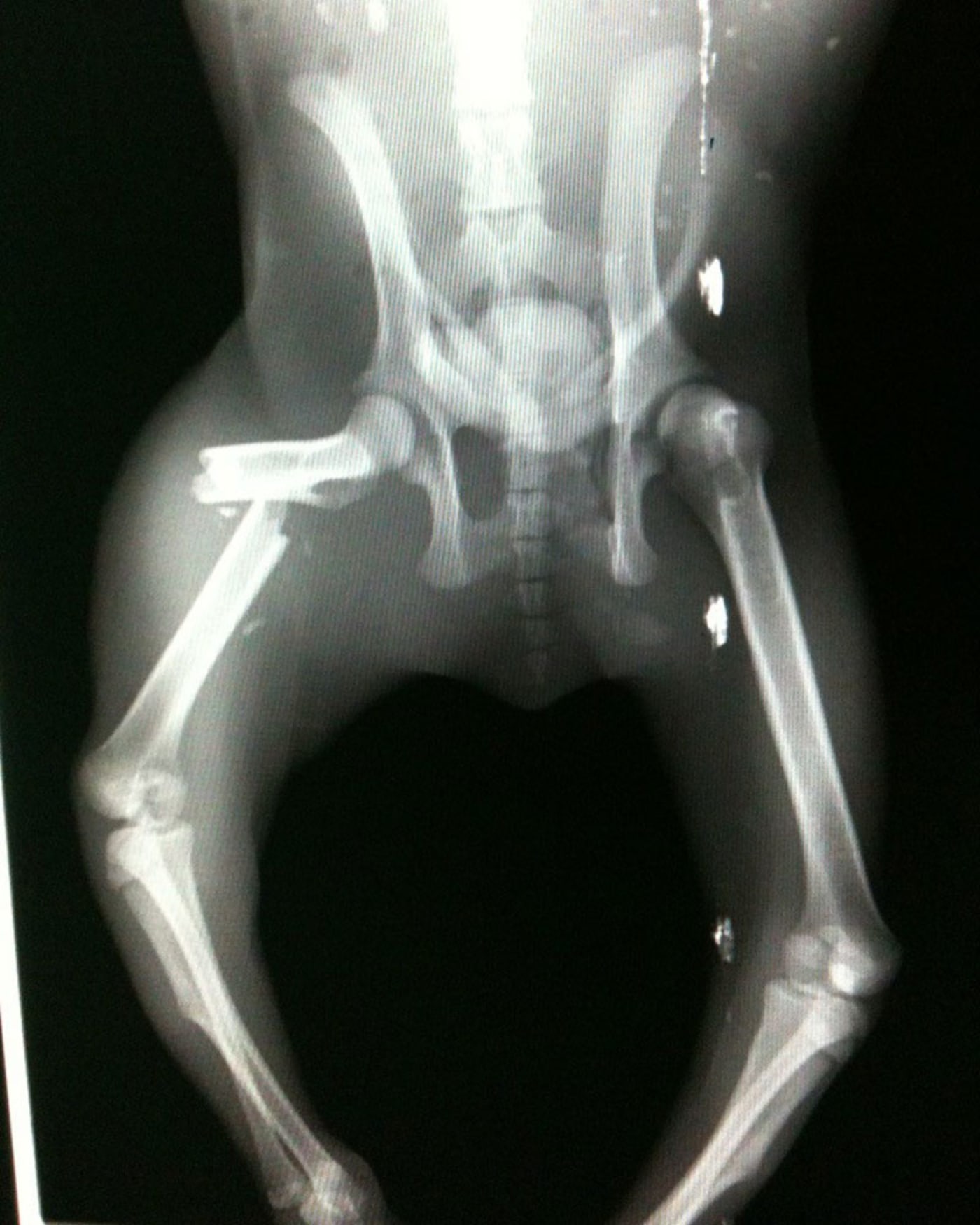 X-ray of koala with leg fracture from vehicle strike, southeast Queensland, April 2017. The koala was from the Moreton Bay region and had orthopaedic repairs on their broken limbs and was luckily able to be released