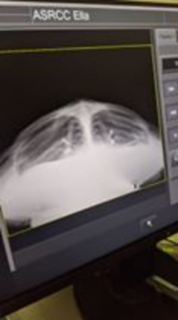 X-ray of Ella the green sea turtle
